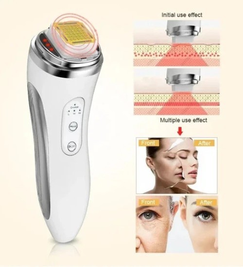 RF Radio Frequency Face Lifting Device Dot Matrix Beauty Skin Tightening Machine