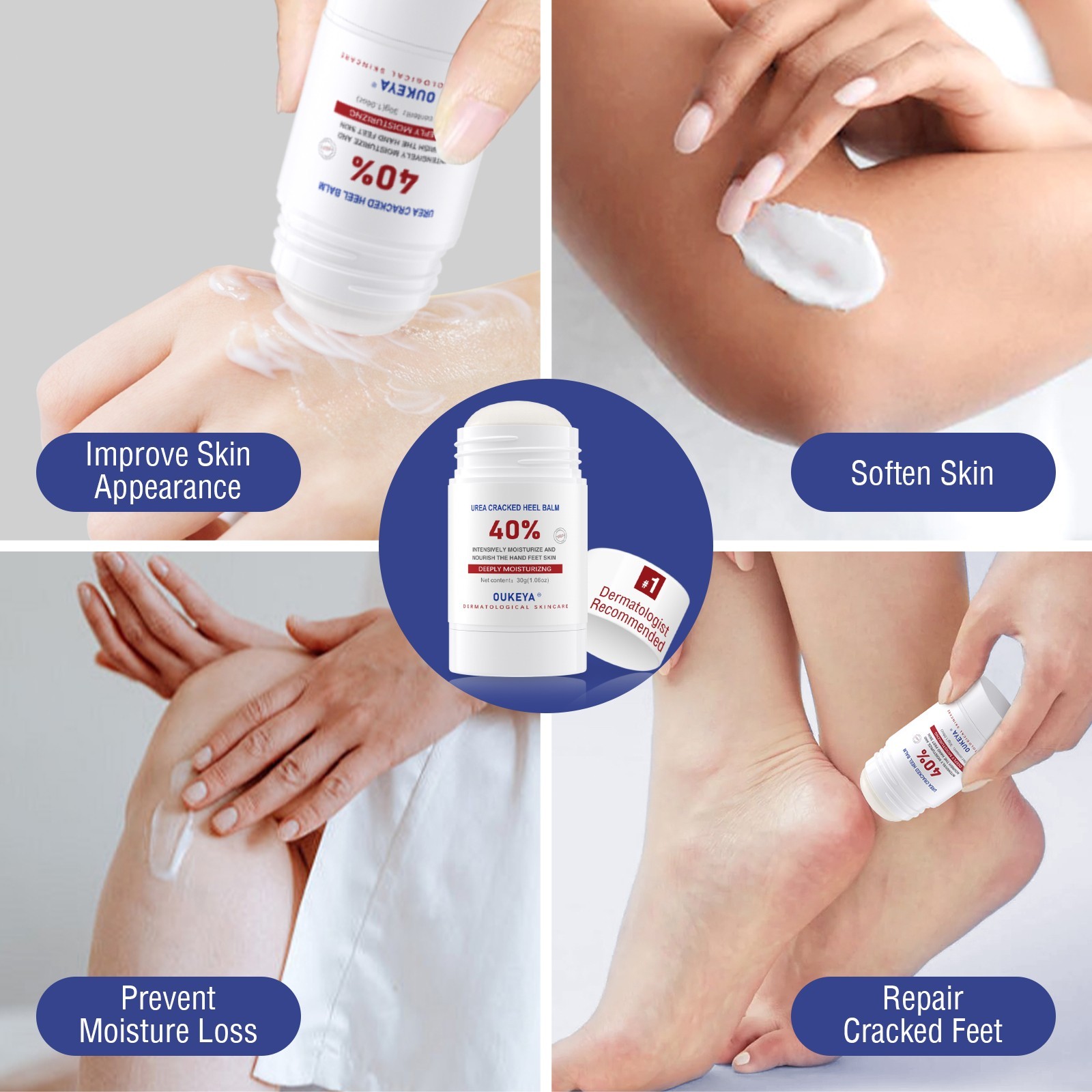 OUKEYA 40% Urea Cream Stick For Cracked Feet & Hands Moisturizer Repair Cream