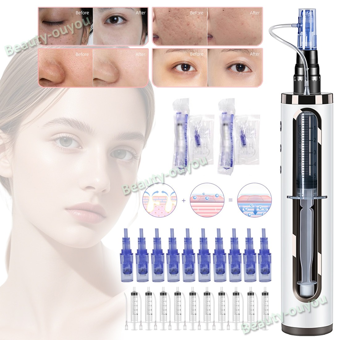 Micro Pen Mesotherapy & 10Pcs 36Pin Replacement Needle Cartridges Tips Face Care
