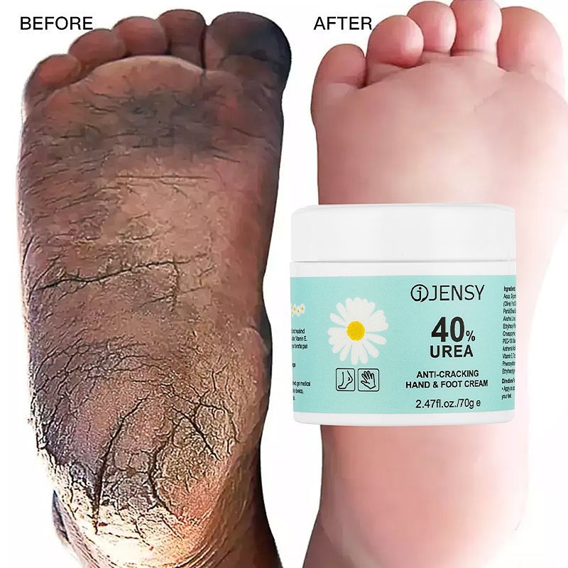 Anti-Drying Crack Hand Foot Care Cream Heel Cracked Removal Dead Skin 2.47fl.oz