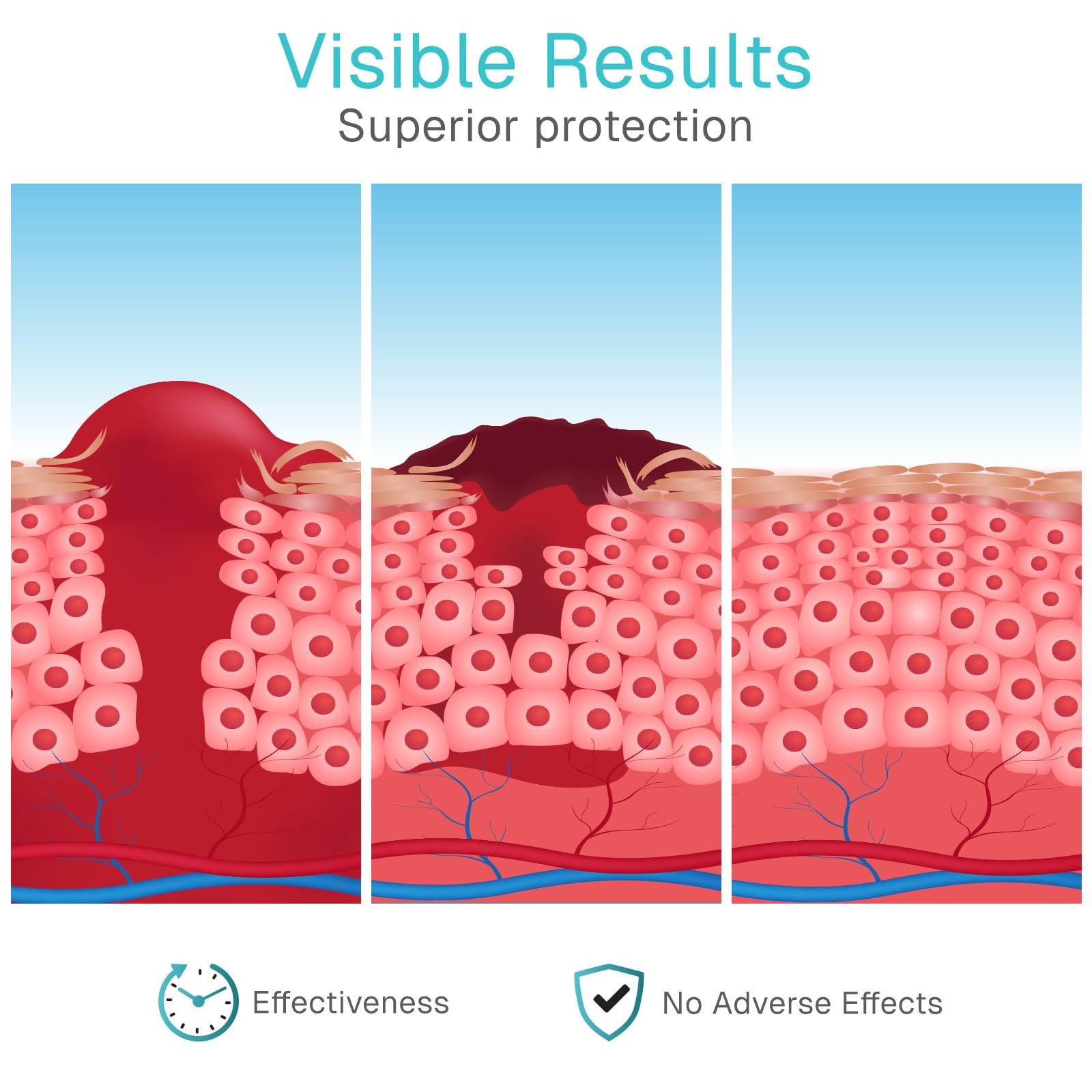 ViveCare Hydrogel: The Ultimate Ouchie Eraser for Cuts, Burns, and Boo-Boos
