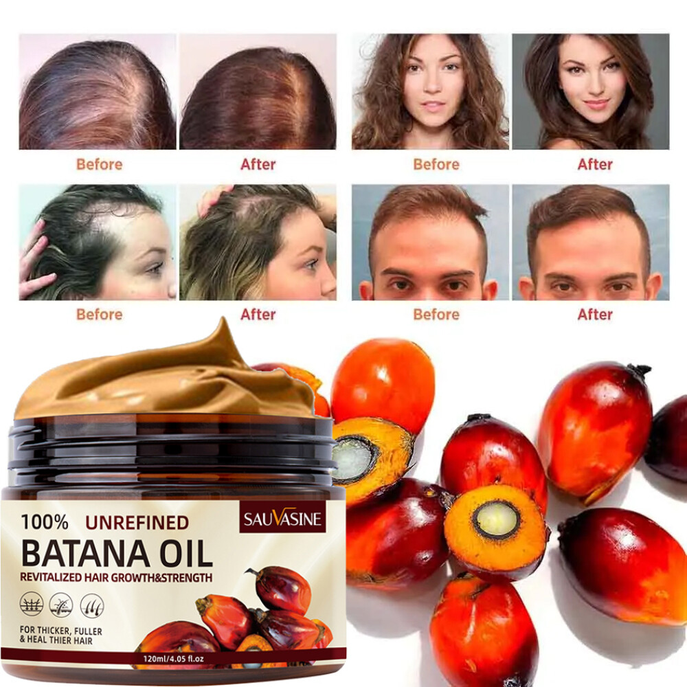 Batana Oil For Hair Growth Hair Loss Treatment Pure Natural Botana Oil Cream US