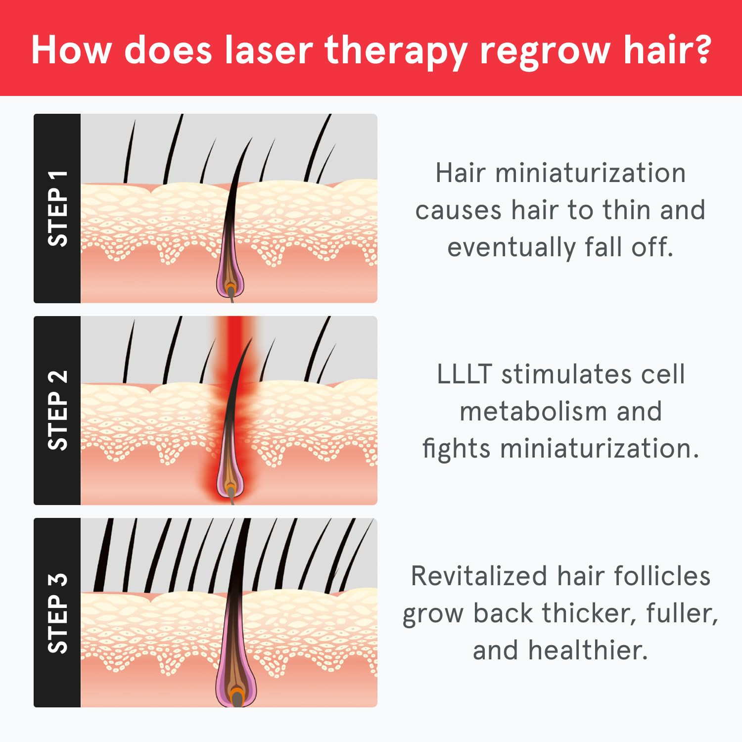 Irestore Essential – Laser Red Light Therapy for Hair Growth – FDA Cleared Hair