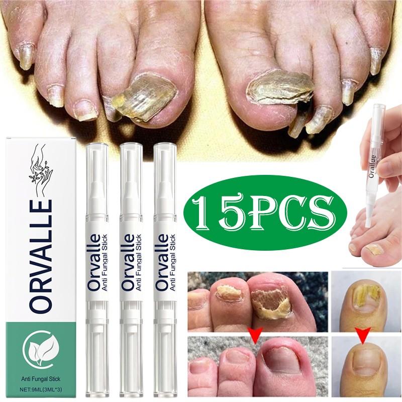 3-15X Orville Nail Fungus Pen Anti Fungus Infection Nail Care Repair Pen Toenail