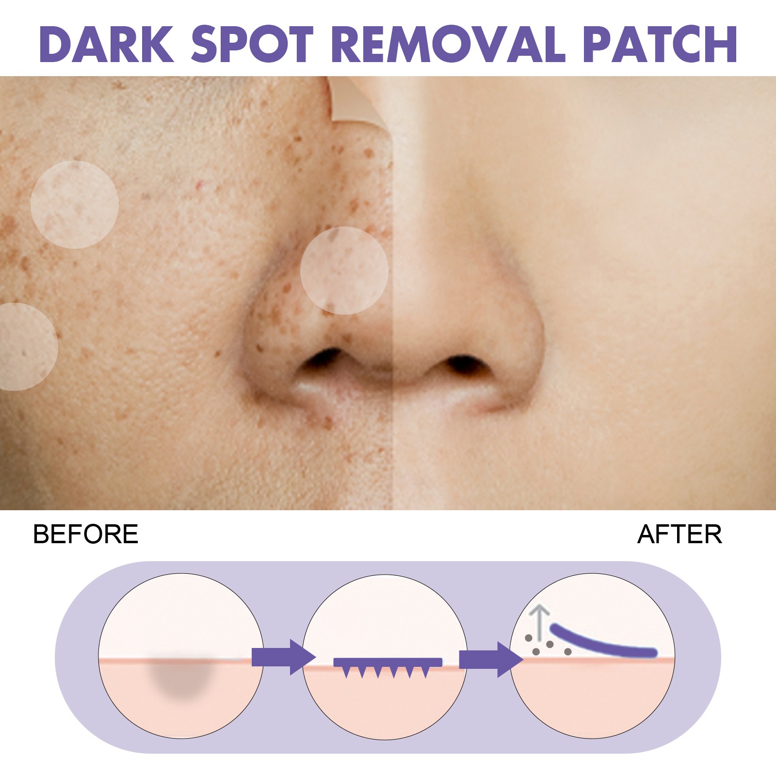 Dark Spot Removal Patch, Lightening Face Dark Spots Melasma Spots Melanin Moistu