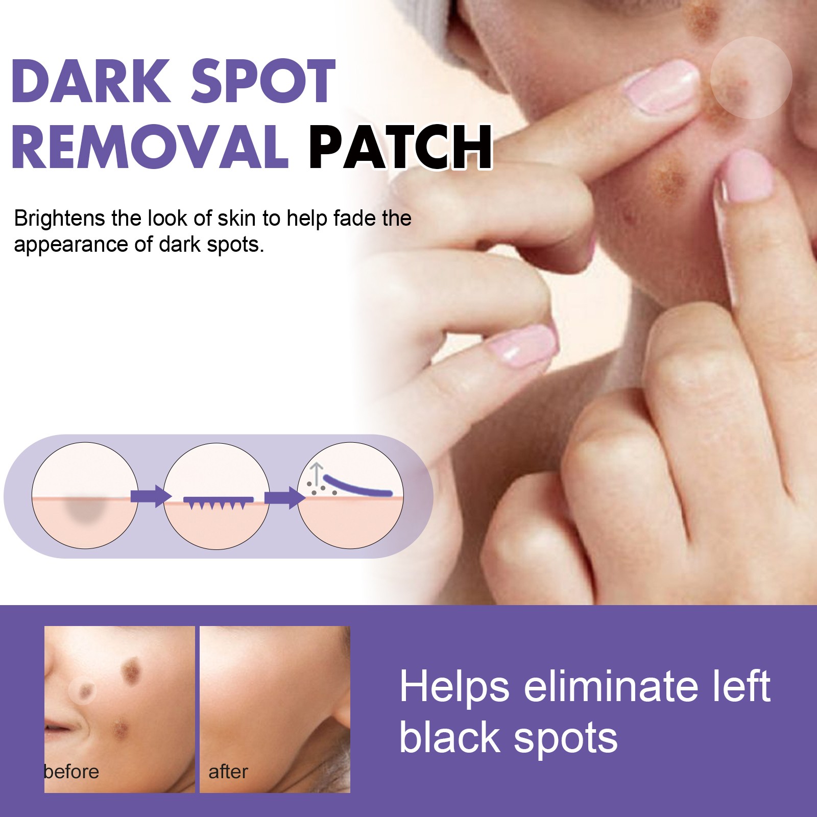 Dark Spot Removal Patch, Lightening Face Dark Spots Melasma Spots Melanin Moistu