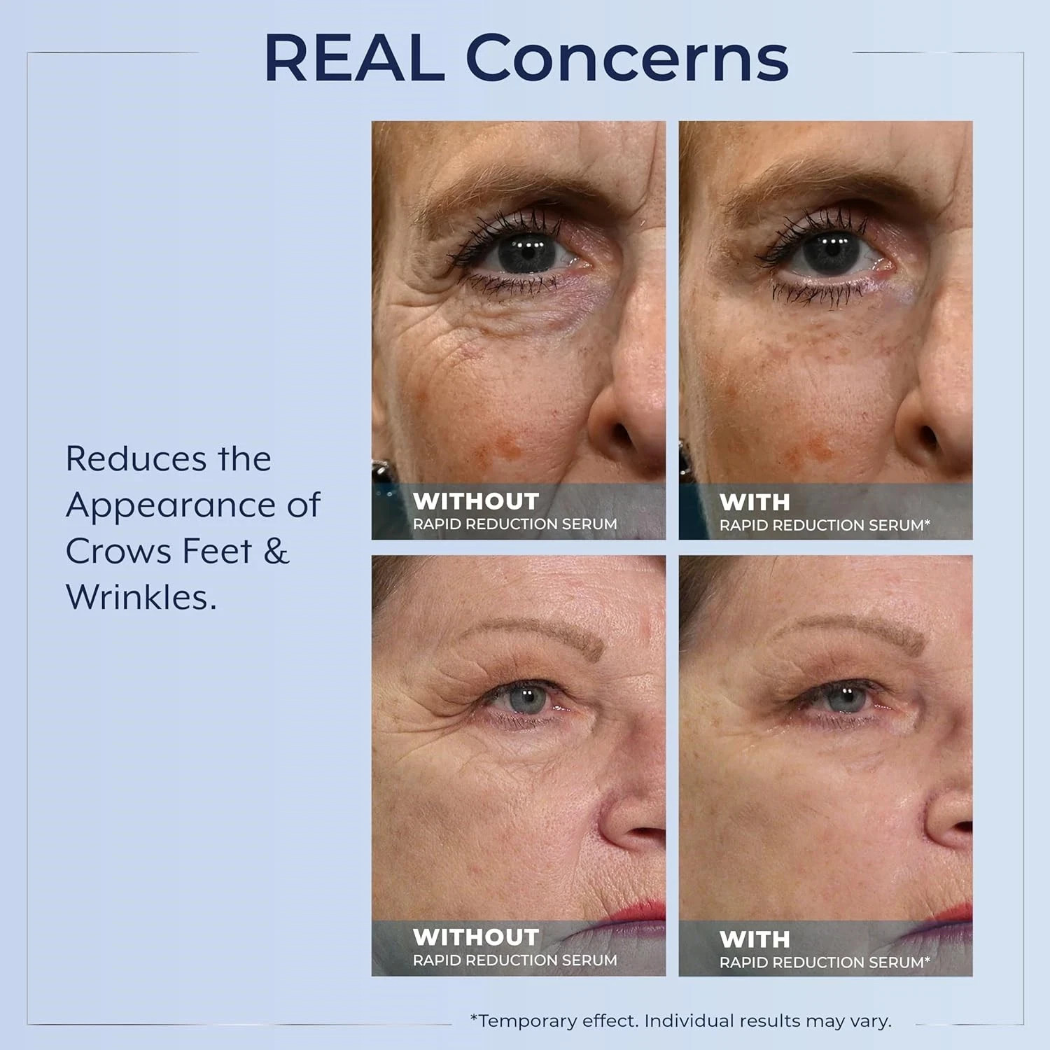 Rapid Reduction Eye Serum – Visibly Reduces Under-Eye Bags, Wrinkles, Dark Circl