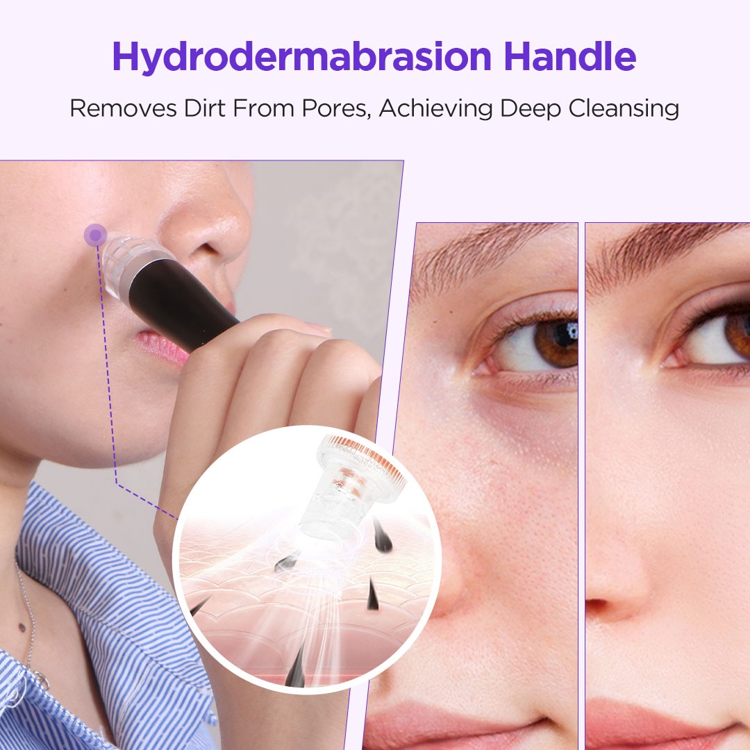 3 in 1 Hydro Dermabrasion Machine for Skin Cleanse + 3*400ml Aqua Peel Solution