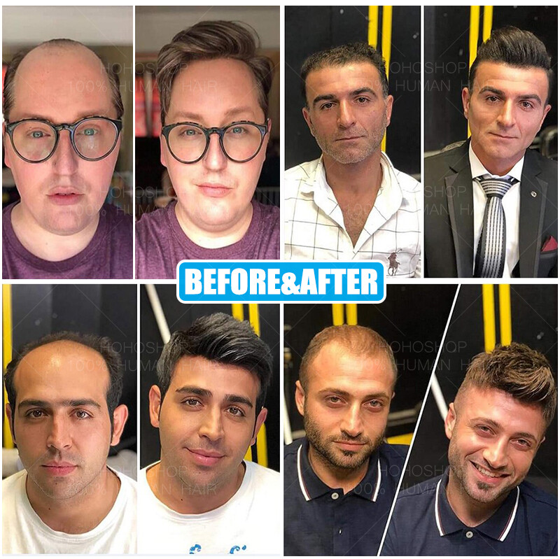 Men Short 1cm Buzz Cut Toupee Replacement System Virgin Human Hair Transparent G
