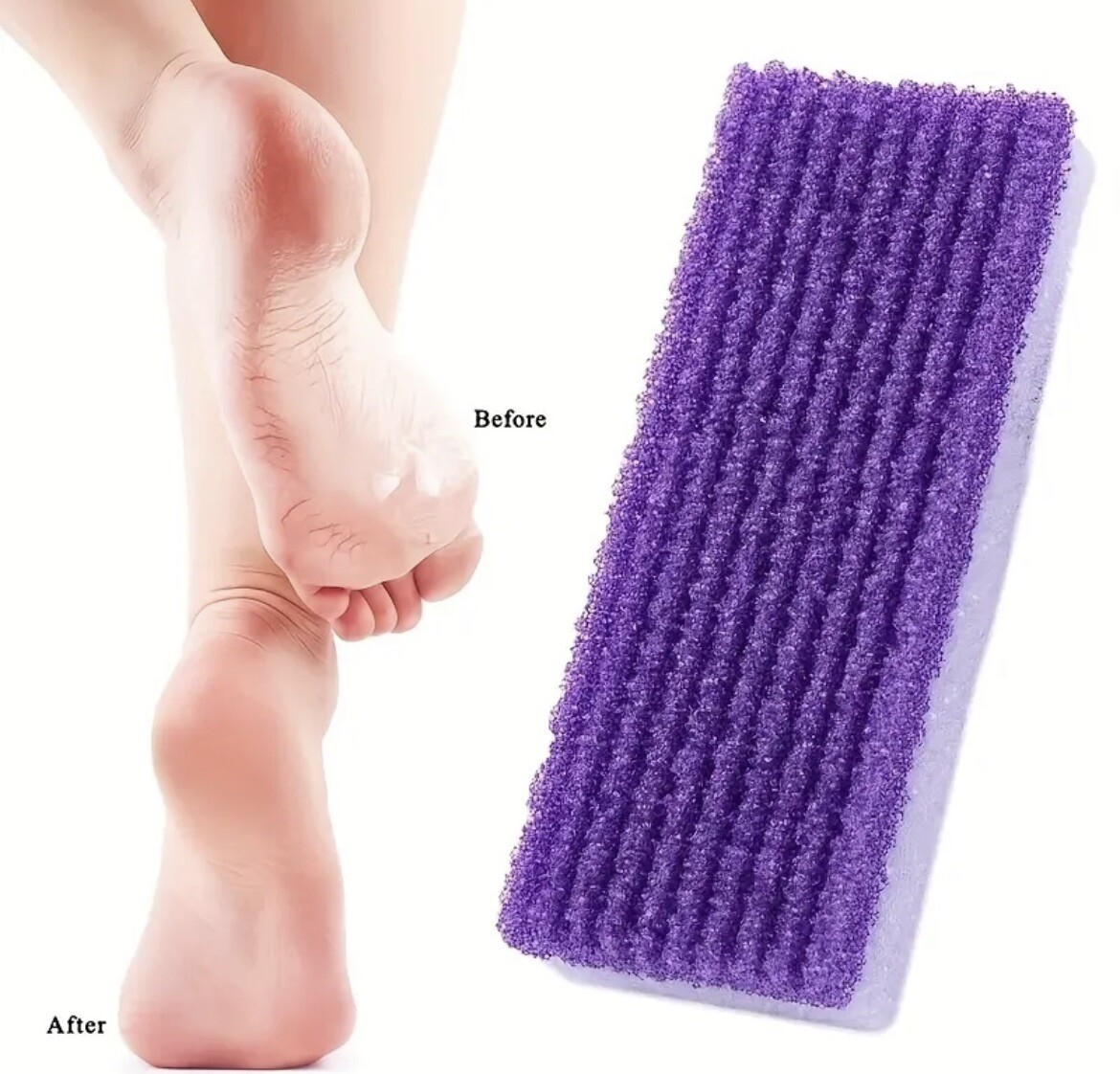 4 PCS Foot Pumice Stone for Feet Hard Skin Callus Remover and Scrubber, Pedicure