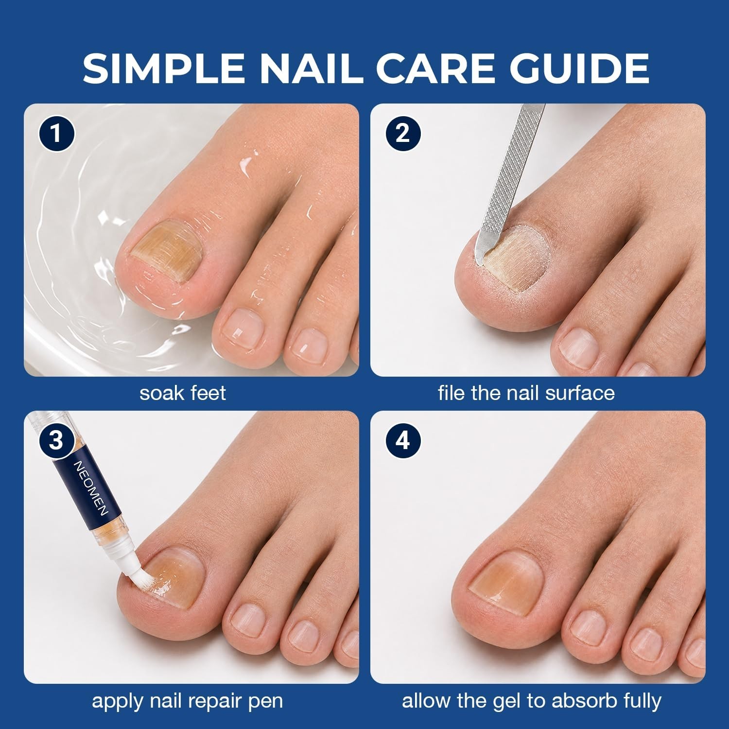 Nail Fungus Pen, Toenail Fungus Pen Treatment for Toenails & Fingernails, Daily