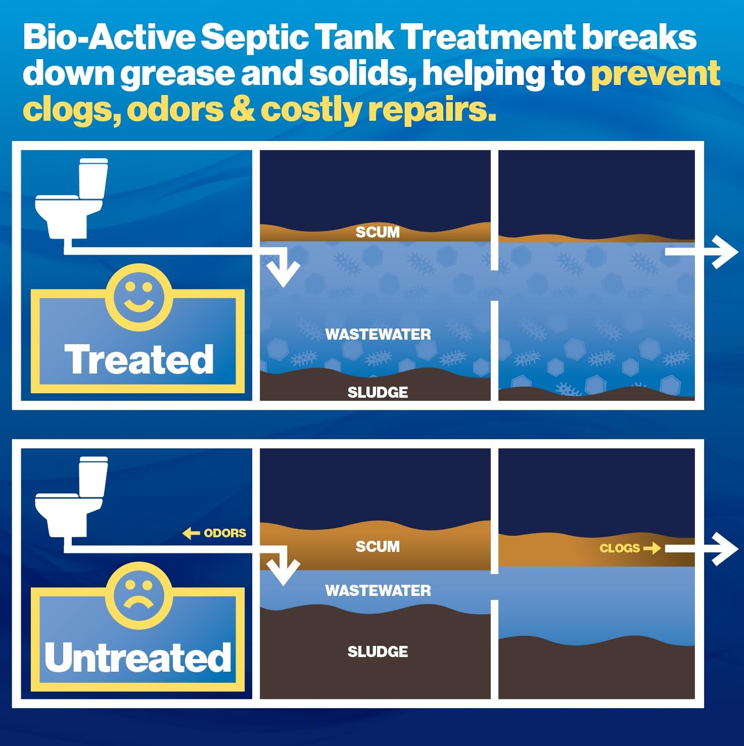 Septic Tank Treatment Bio Active 1 Year Supply 12 Pack Walex BIO-31112 Home