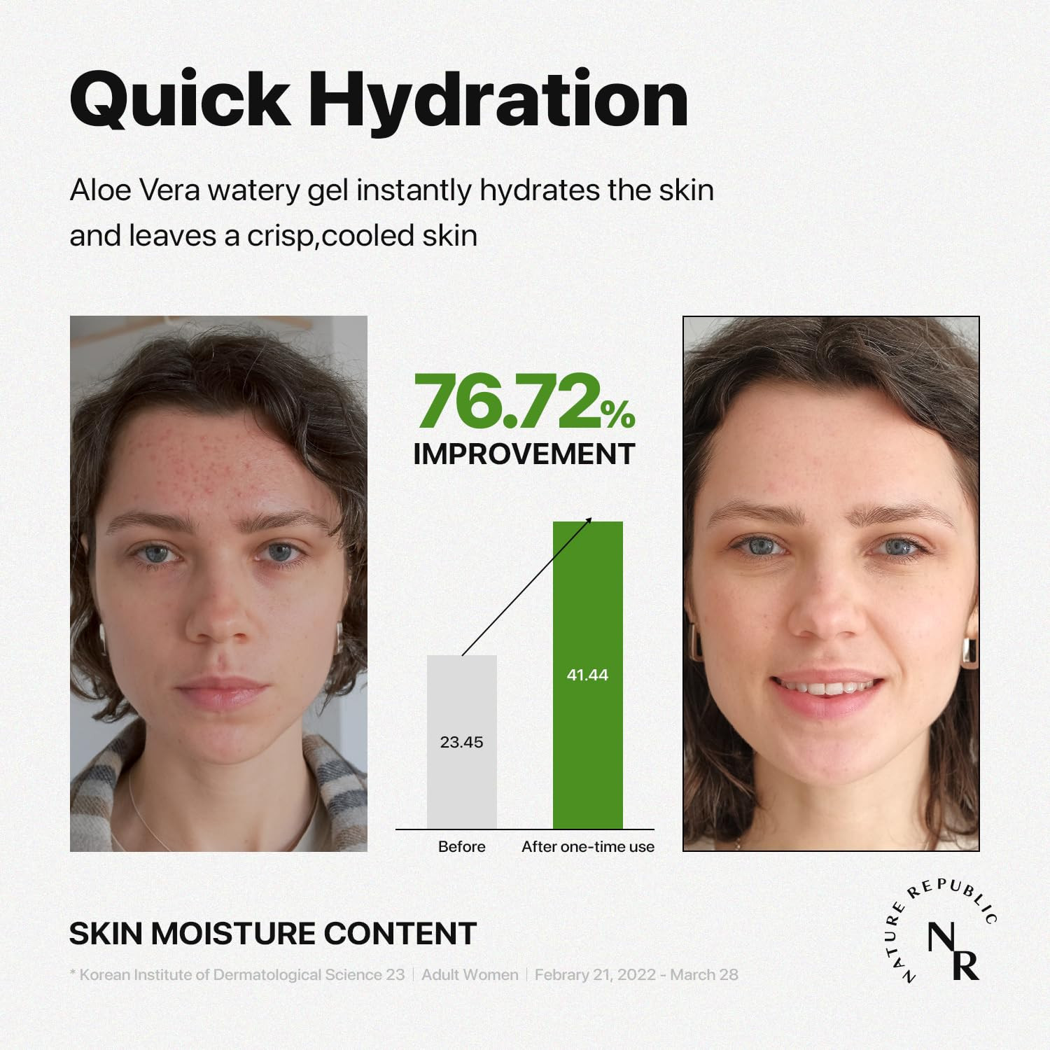 Mild & Moisture Aloe Vera Watery Gel (1 PCS) | Hydrating & Moisturizing, Fast-Ab