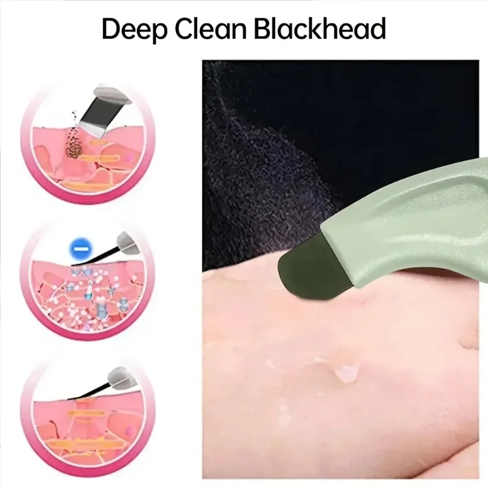 Blackhead & Whitehead Removal Tool – Acne Extractor Facial Scraper For Skin Care