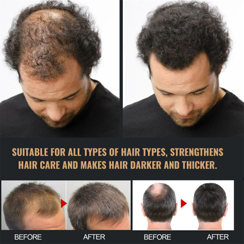 1-3PCS 200ml Root Activator Shampoo SPARTAN Hair Loss Shampoo Root Activator