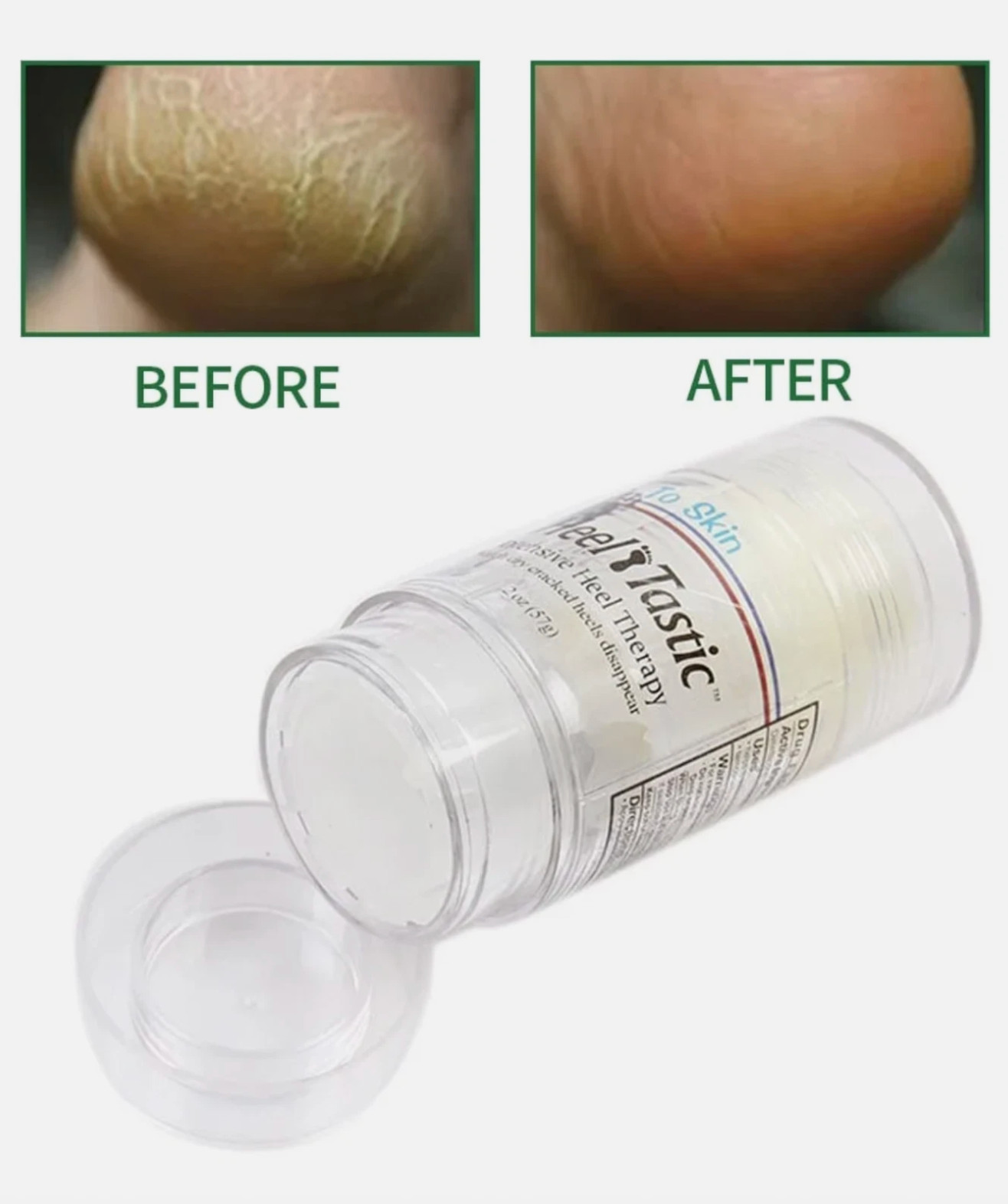 Heel Tastic Intensive Heel Therapy, Foot Care 2oz, FAST FREE SHIPPING