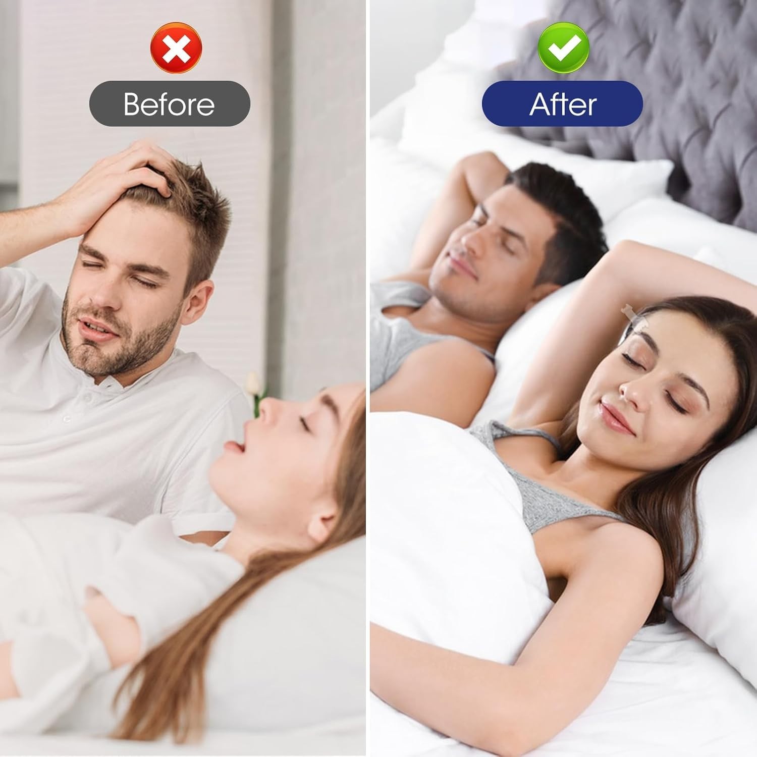 Portable 300 Count Nasal Strips – Effective Snoring Reduction & Breathability
