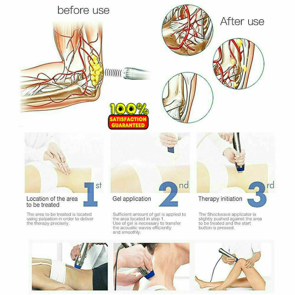 Shockwave Therapy Machine Shock Wave Body Massager for Pain Relief ED Treatment