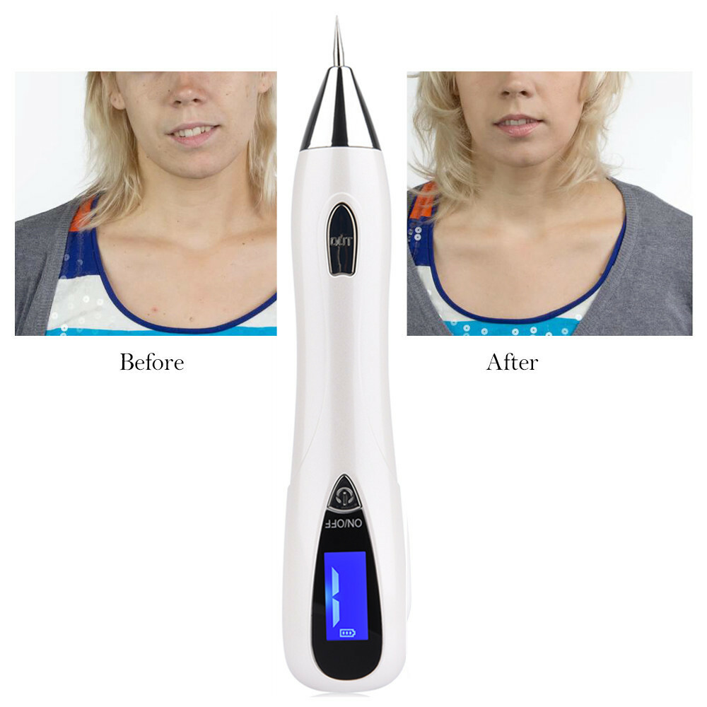 Electri Laser Skin Tag Freckle Wart Dot Mole Remove Pen Dark Spot Tattoo Removal