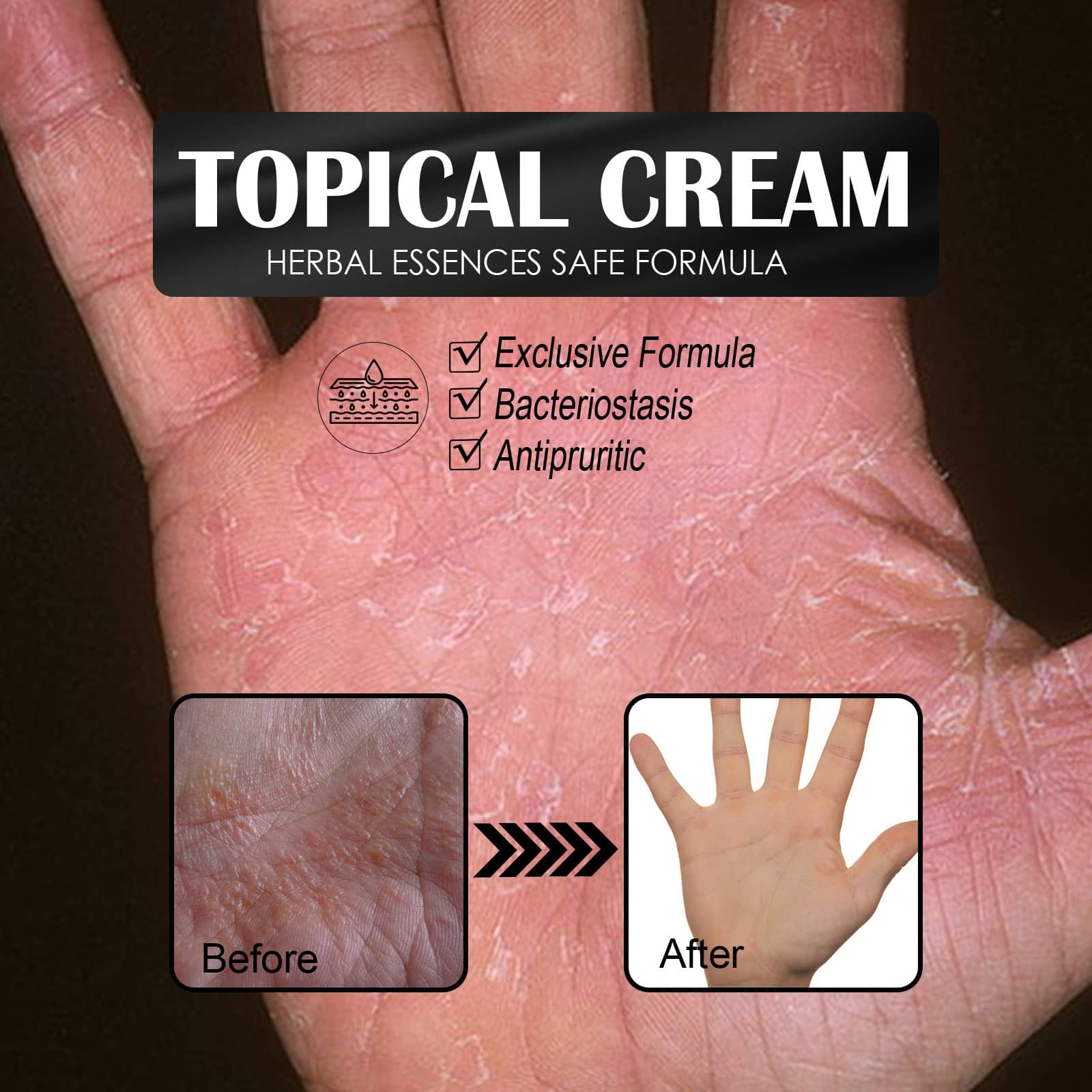 Herbal Topical Cream Soothing Dry Itching Skin Repairing Hand Foot Fungus Care