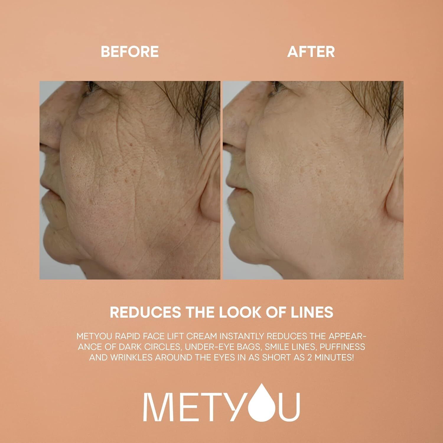 Instant Face Lift Face and Eye Tightening and Lifting Serum in 2 Minutes, 1 oz