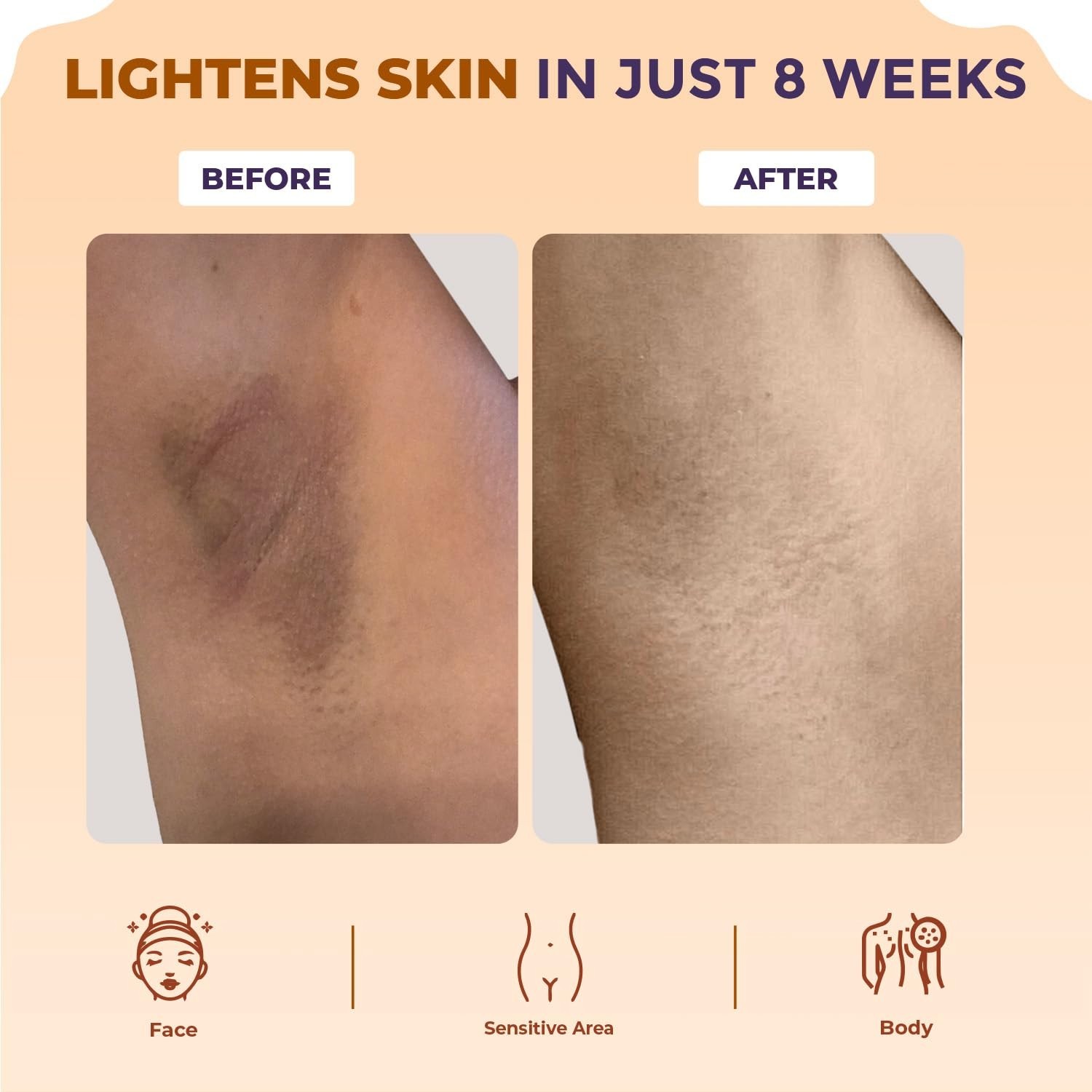 Sanfe Body Lightening Oil Body Pigmentation & Dark Patches 100gm