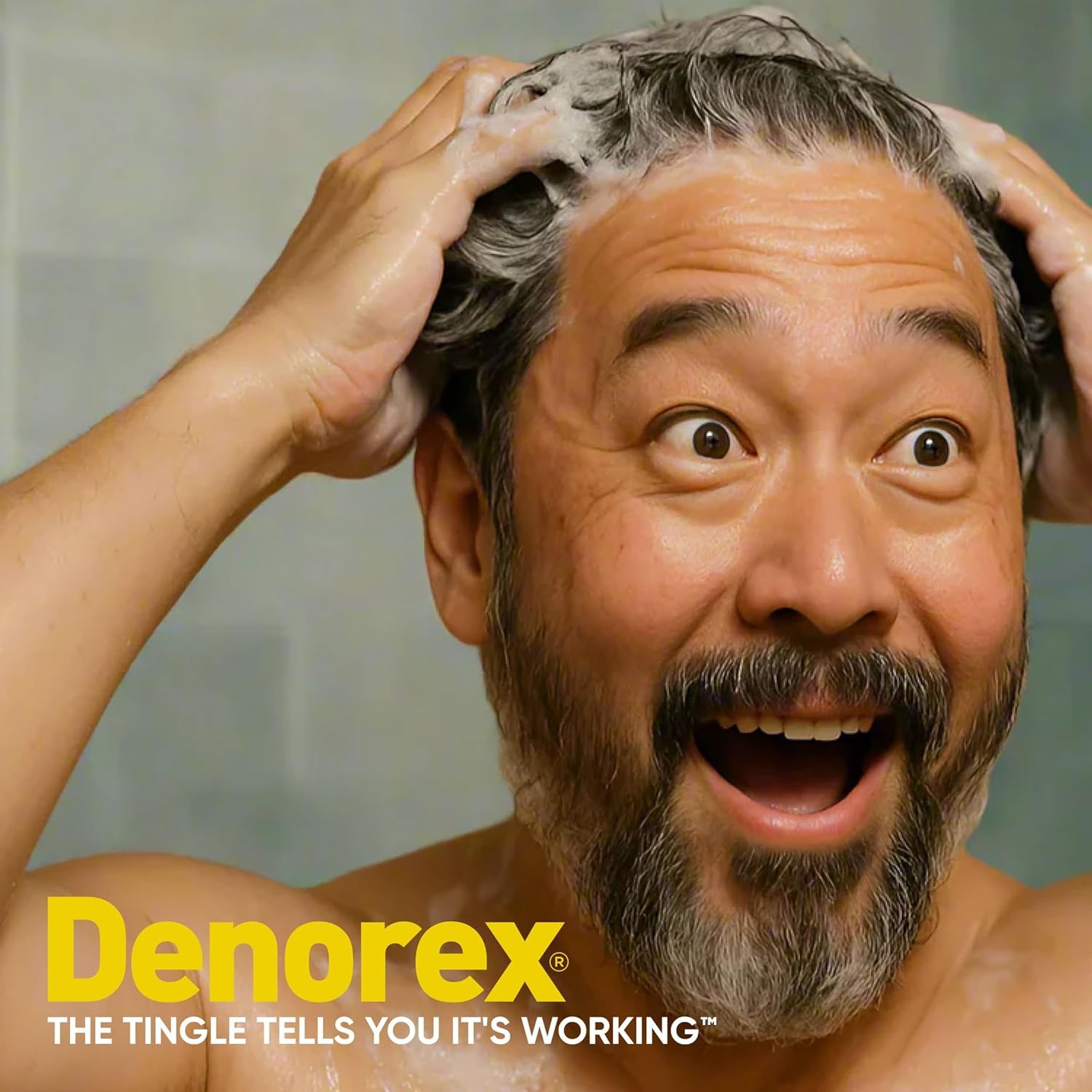Denorex Severe Flake Relief Shampoo 2in1 Anti Dandruff 10 oz