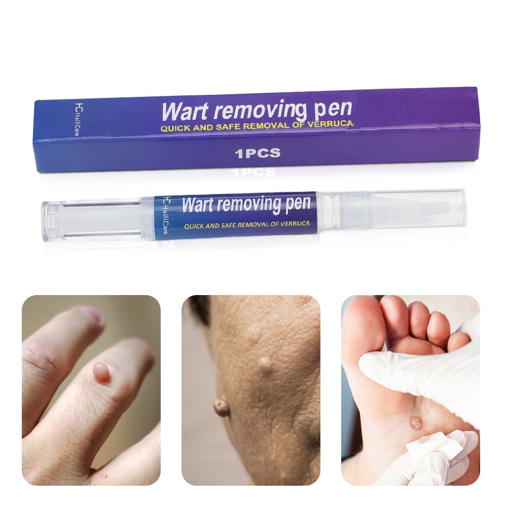 12 Hours Wart Remover Pen Skin Tag Mole Remover Eliminate Foot Corn Warts Unisex