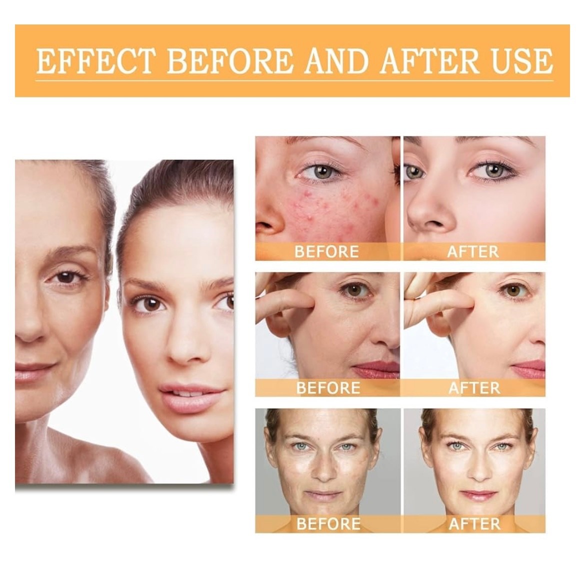 Glycolic Acid 7% Toning Solution Reverses Skin Aging 3.38 oz (100ml) Free Ship