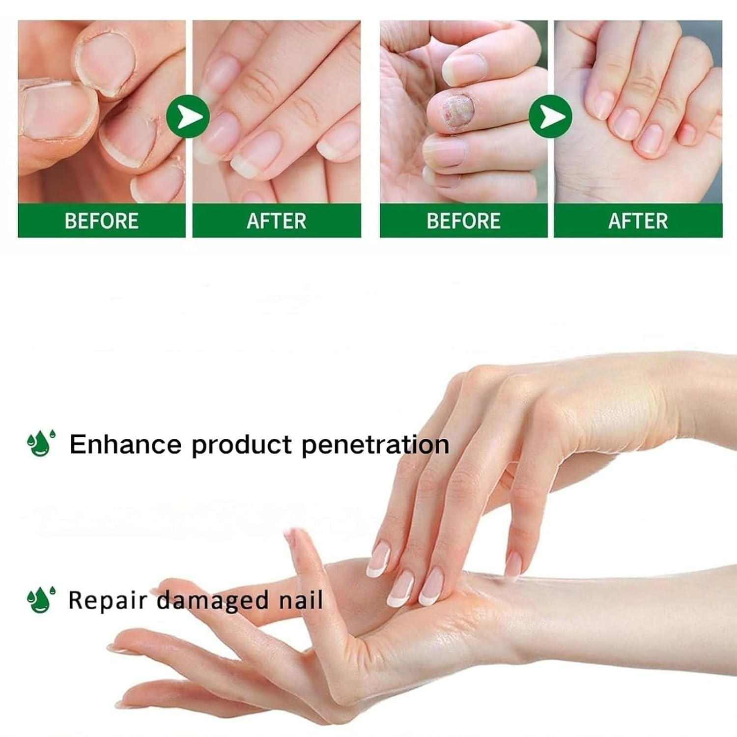 7-Day Toenail Fungus Treatment (2 Pack) Extra Repair for Discolored Nails 30MLx2