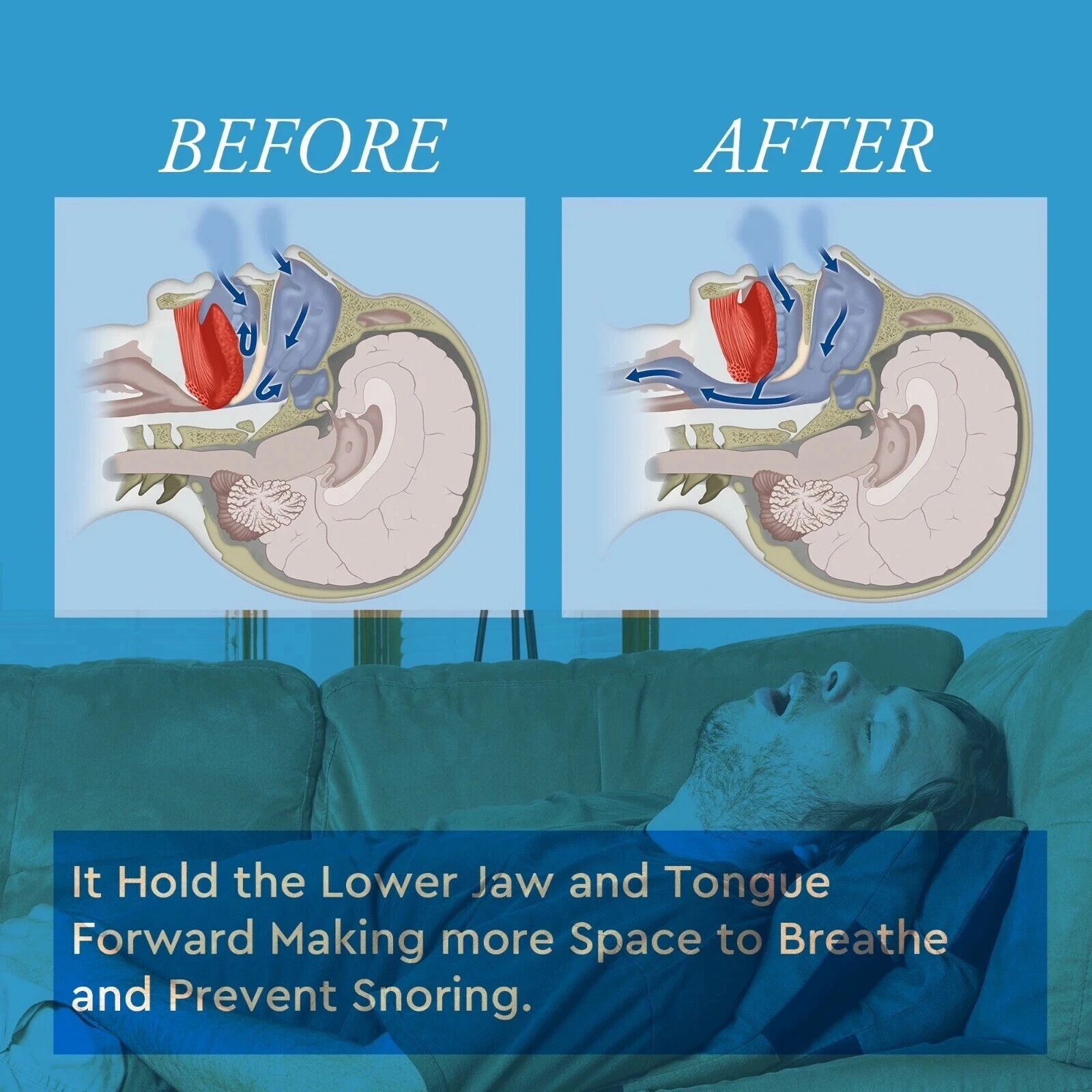 Stop Snoring Mouthpiece Sleep Apnea Guard Bruxism Anti Snore Pure Grind Aid Tray