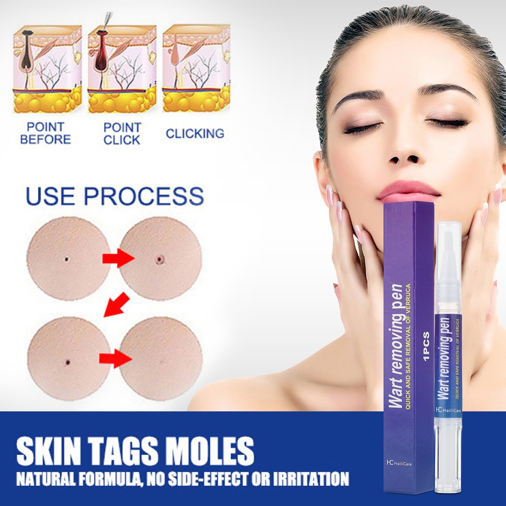 12 Hours Wart Remover Pen Skin Tag Mole Remover Eliminate Foot Corn Warts Unisex