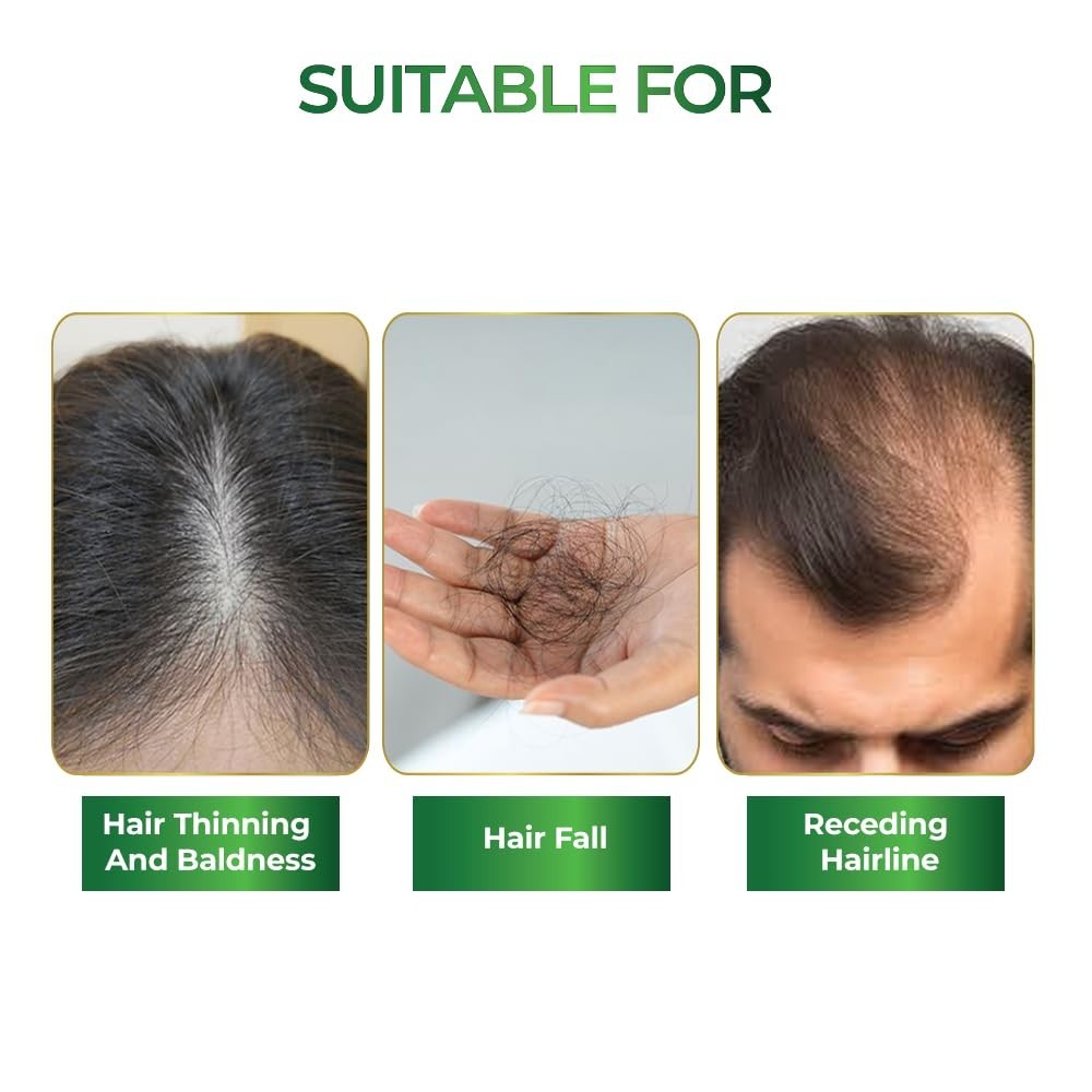Streax Rosemary Hair Spray – 100% Natural Extracts For Hair Growth 200ml
