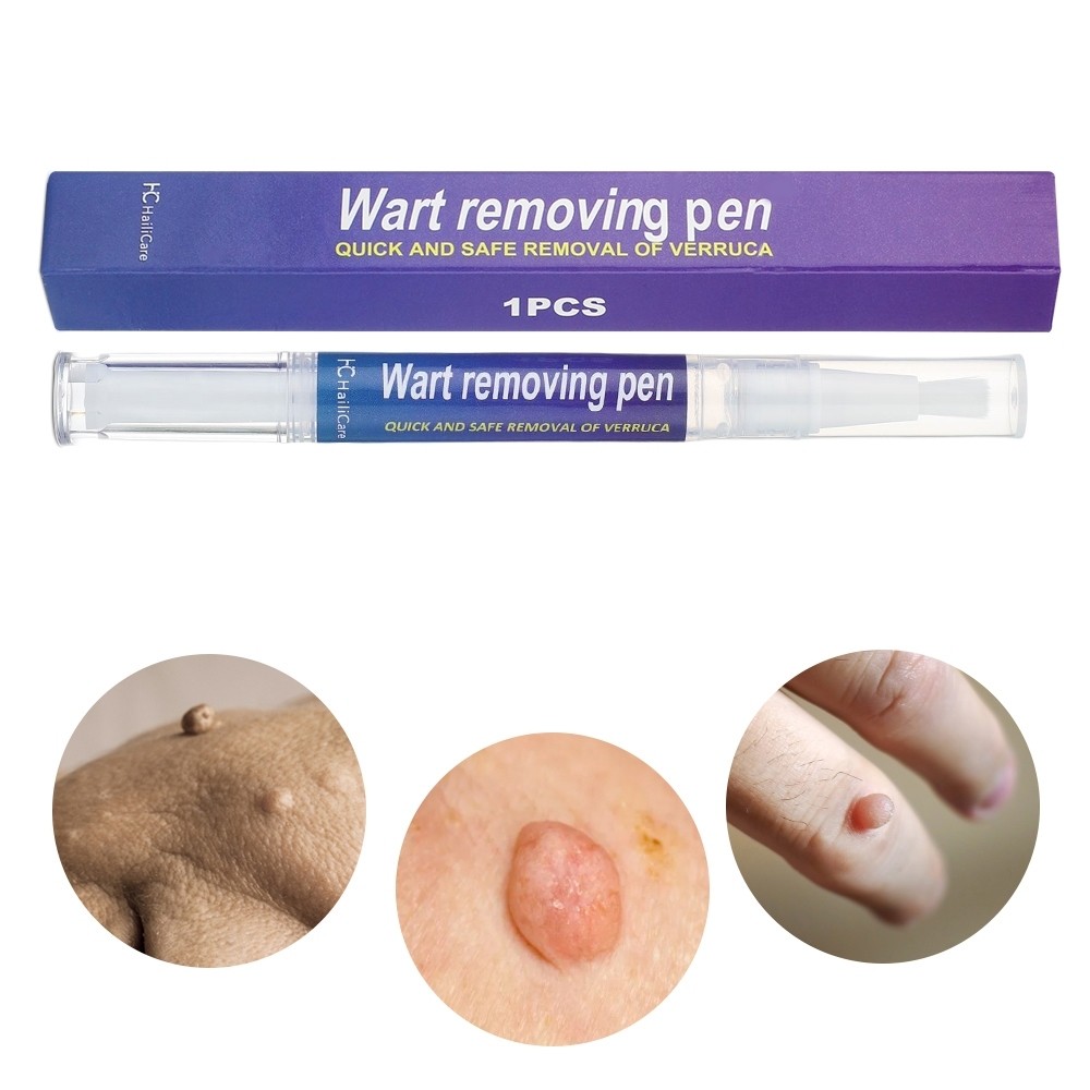 12 Hours Wart Remover Pen Skin Tag Mole Remover Eliminate Foot Corn Warts Unisex