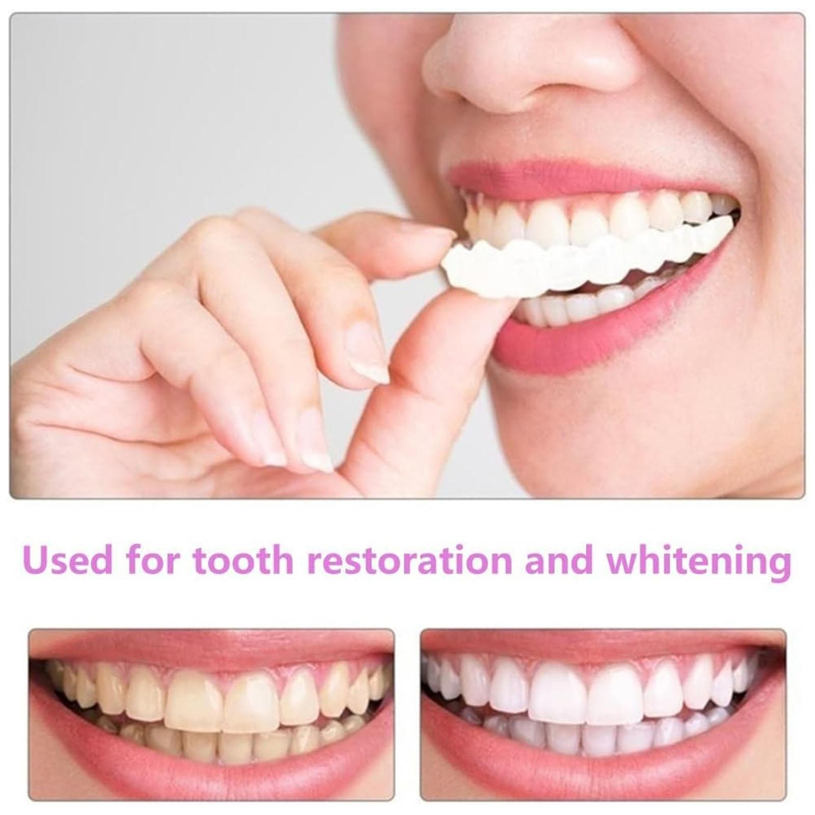Perfect Smile Top And Bottom False Teeth Veneers Cover Instant Cosmetic Clip Up