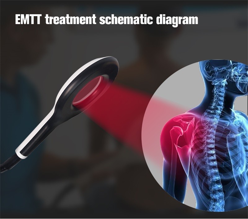 Physical PEMF Magnetic Therapy Magneto EMTT Joint Knee Body Pain Relief Machine