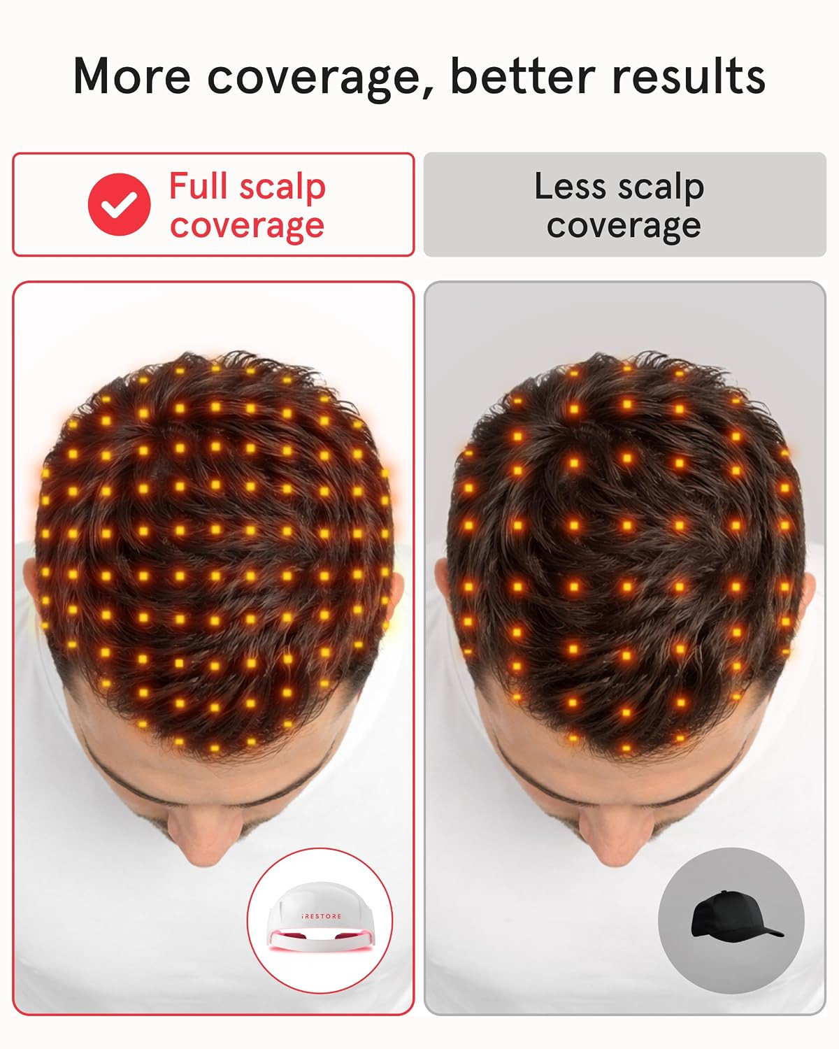 Irestore Essential – Laser Red Light Therapy for Hair Growth – FDA Cleared Hair