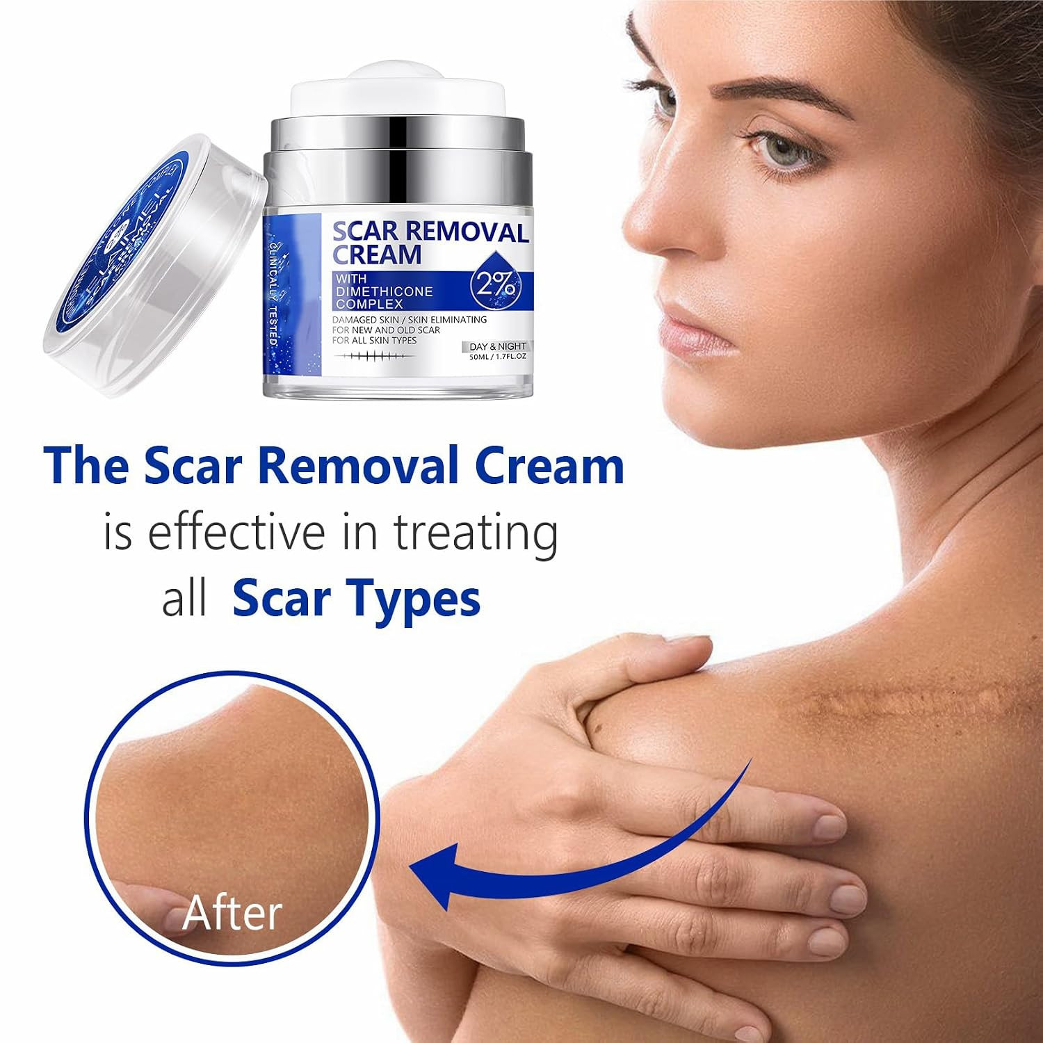 Scar Cream, Scar Removal Cream – Advanced Scar Cream for Surgical Scars, Acne Sc