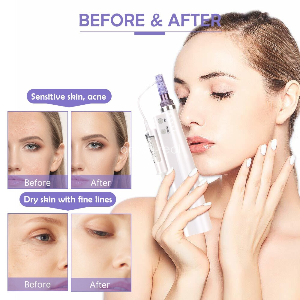 2026 New Skin Rejuvenation Spa Pen for wrinkle Removal and Anti-aging Skin Care