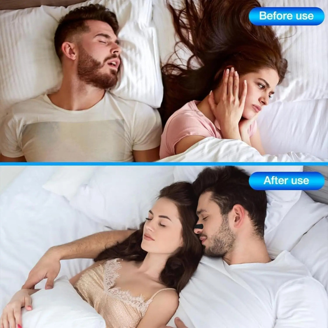Extra Strength Nasal Strips (30 Pack) – Congestion & Snoring Relief!