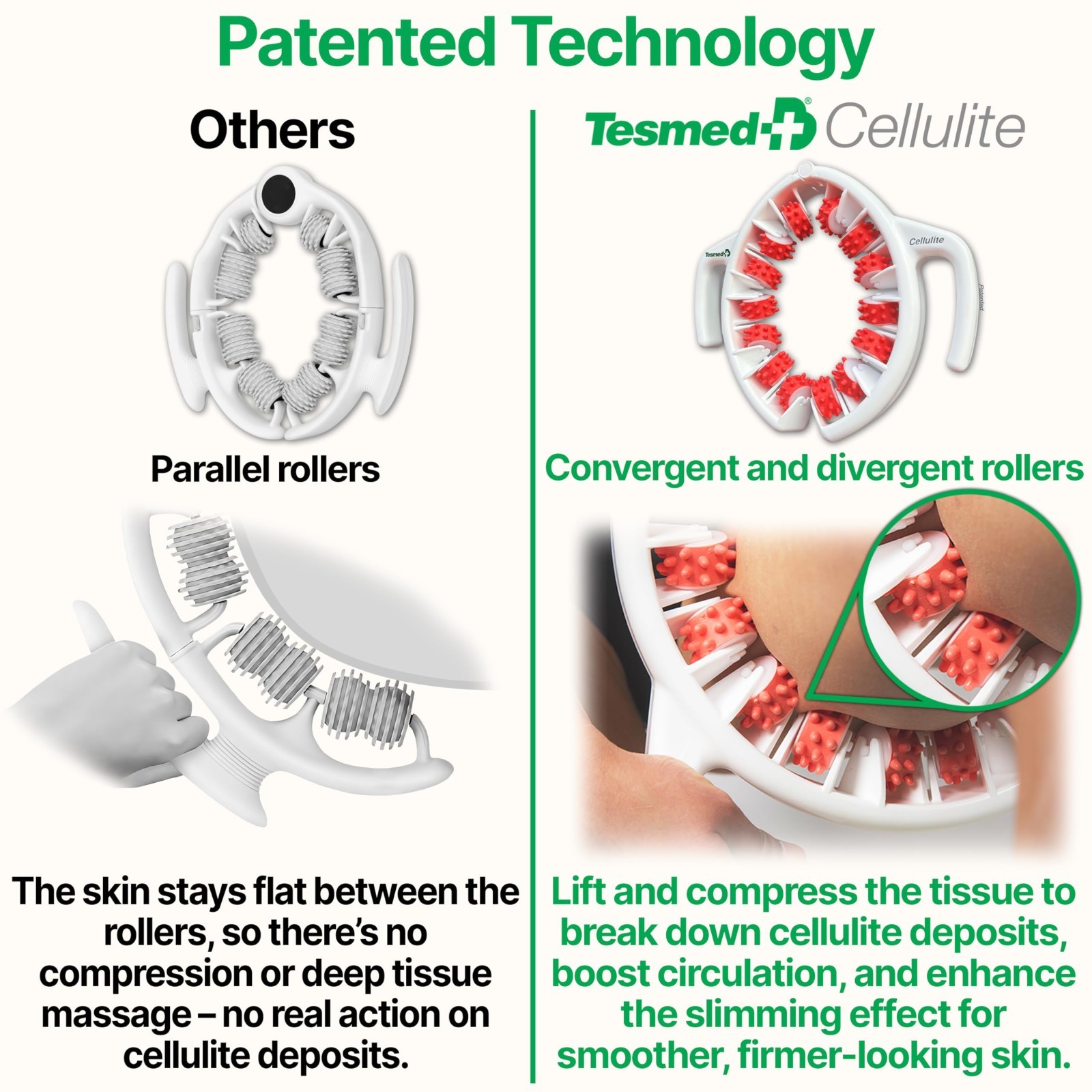 Cellulite Massager Roller for Thighs & Buttocks | Patented Italian Design, Anti-
