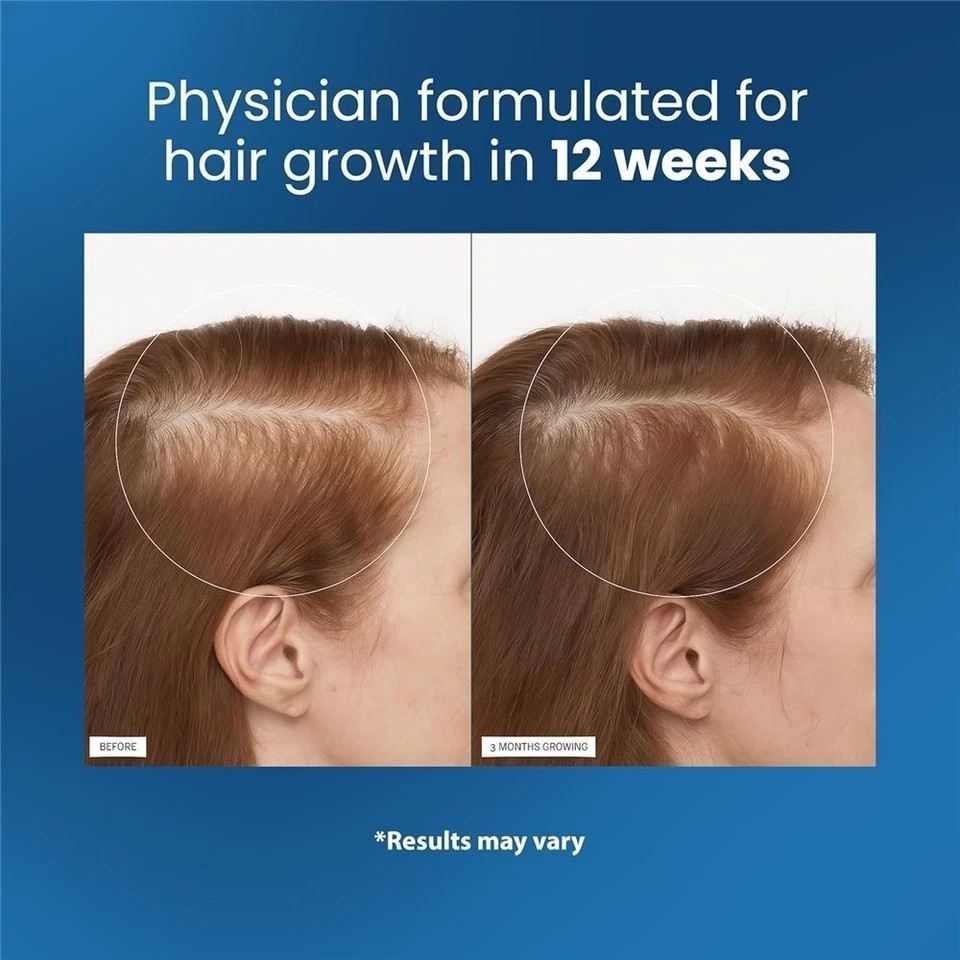 NEW Be Bodywise Hair Growth Serum Roll On – 3% Rosemary, 3% Redensyl & 2% – 25ml