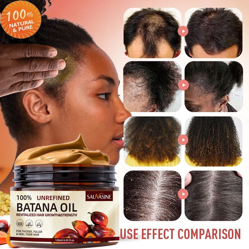 Batana Oil For Hair Growth Hair Loss Treatment Pure Natural Botana Oil Cream US