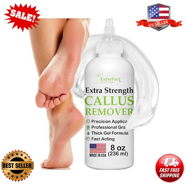 Callus Remover for Feet (Extra Strength 8 Oz) Foot Callus Remover Gel, Spa Foot