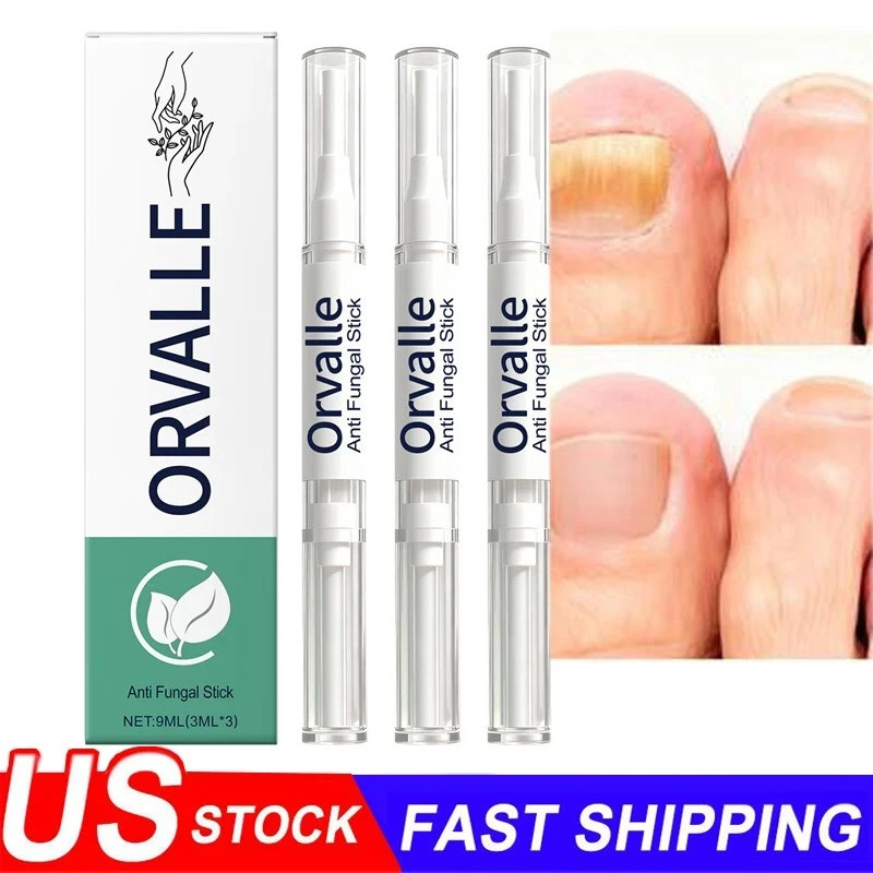 3PCS Orville Nail Fungus Pen Anti Fungus Infection Nail Care Repair Pen Toenail