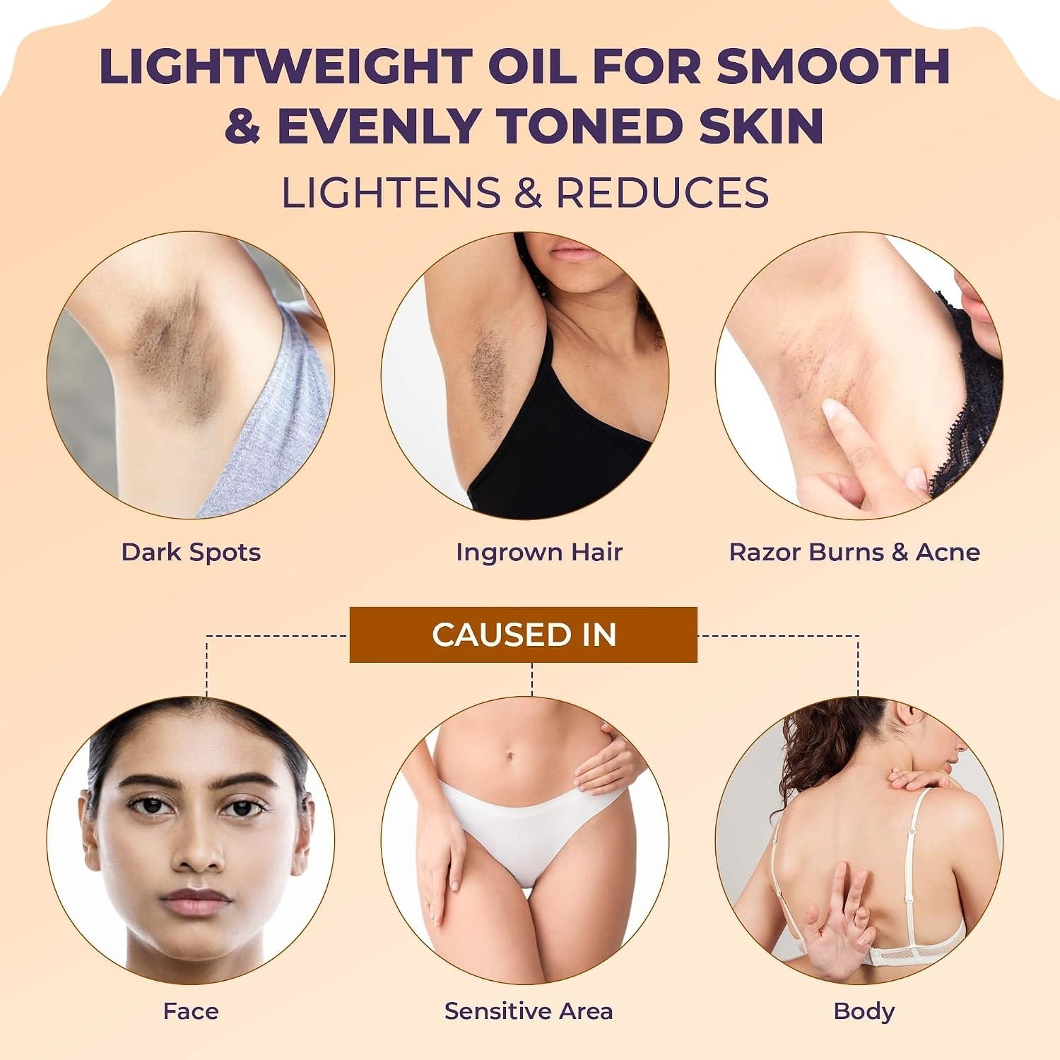 Sanfe Body Lightening Oil 100gm For Body Pigmentation & Dark Patches