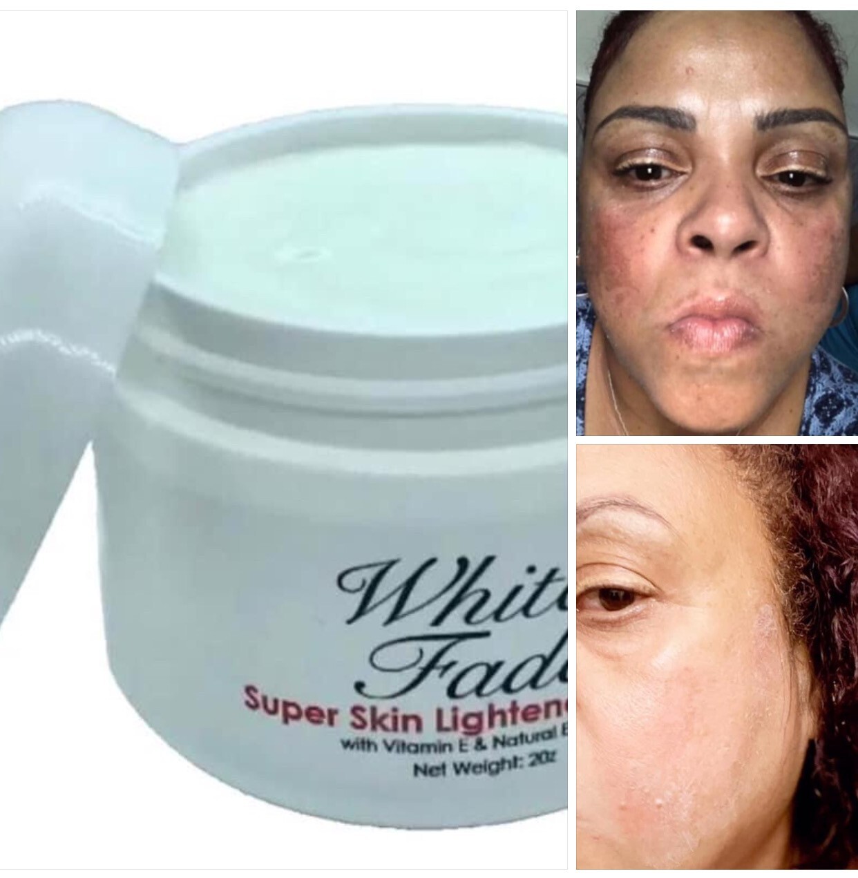 WHITE FADE SUPER SKIN LIGHTENER; PARA REMOVER MANCHAS OSCURAS DE LA PIEL, 2oz