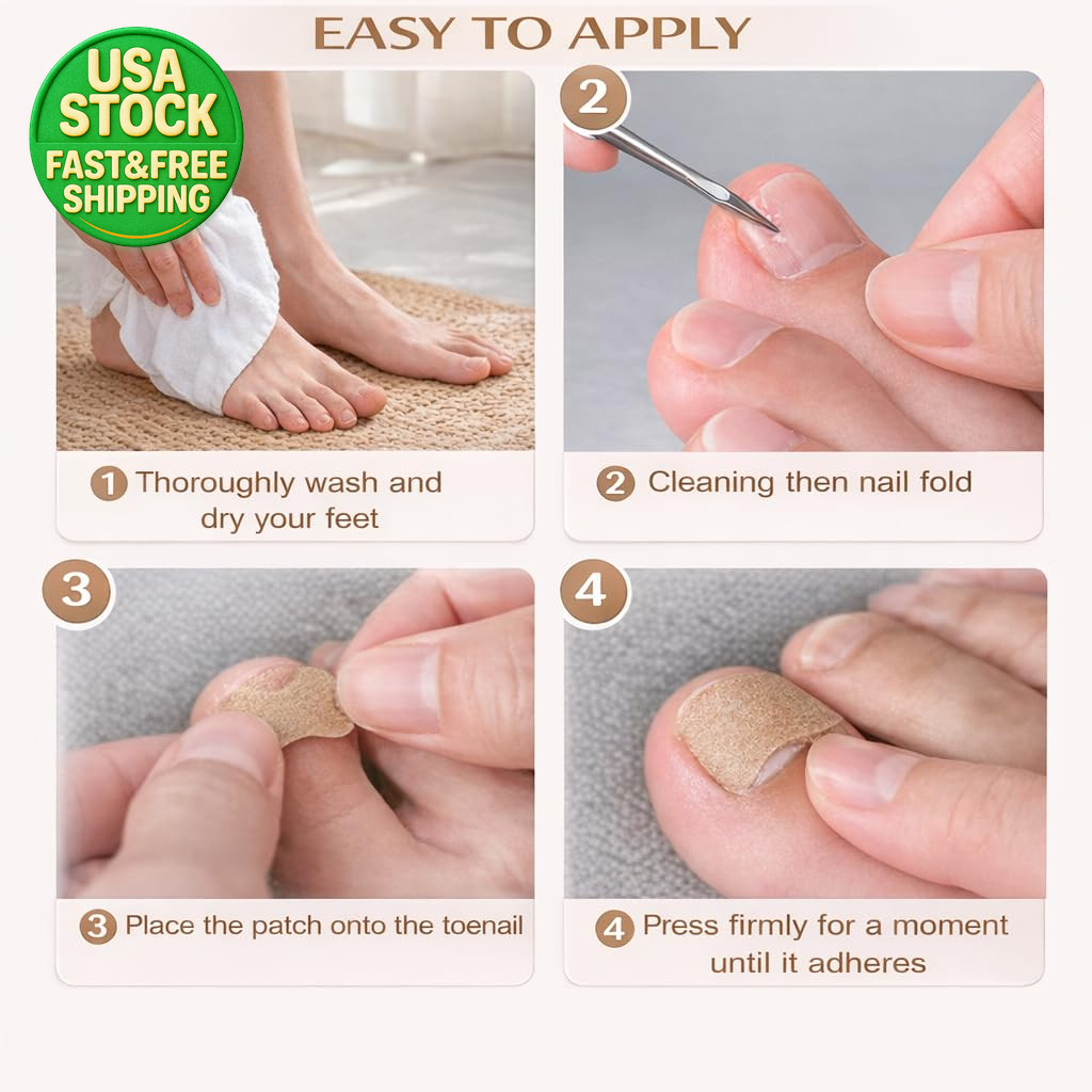 Ingrown Toenail Corrector Kit Stainless Steel Tools Breathable Toe Sleeves