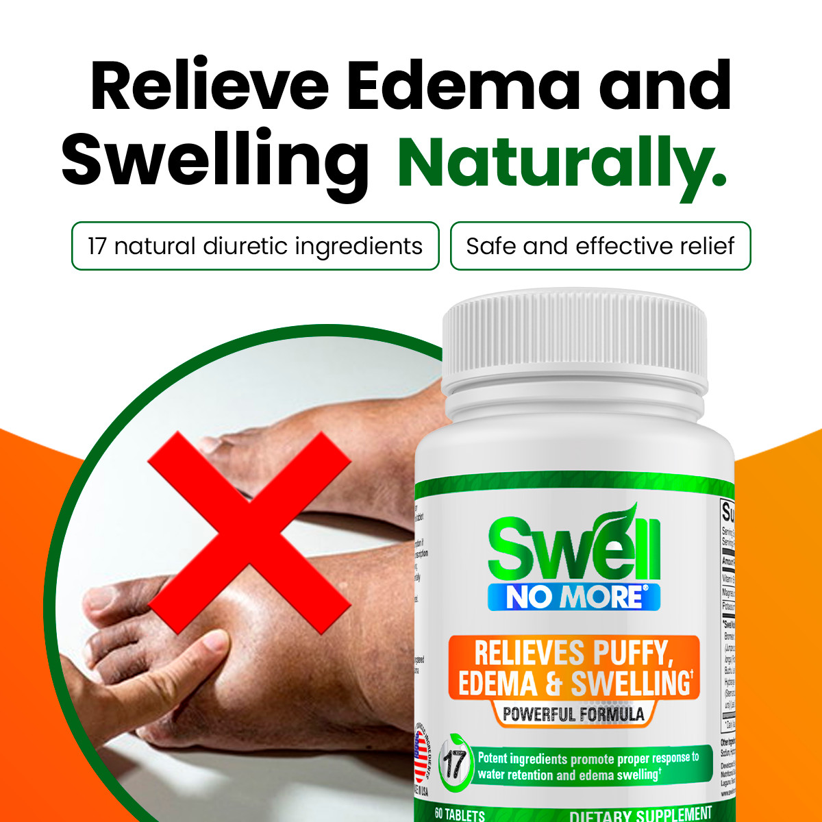 Swell No More Reduces Puffy Eyes Swollen Feet Legs Ankles Edema Swelling