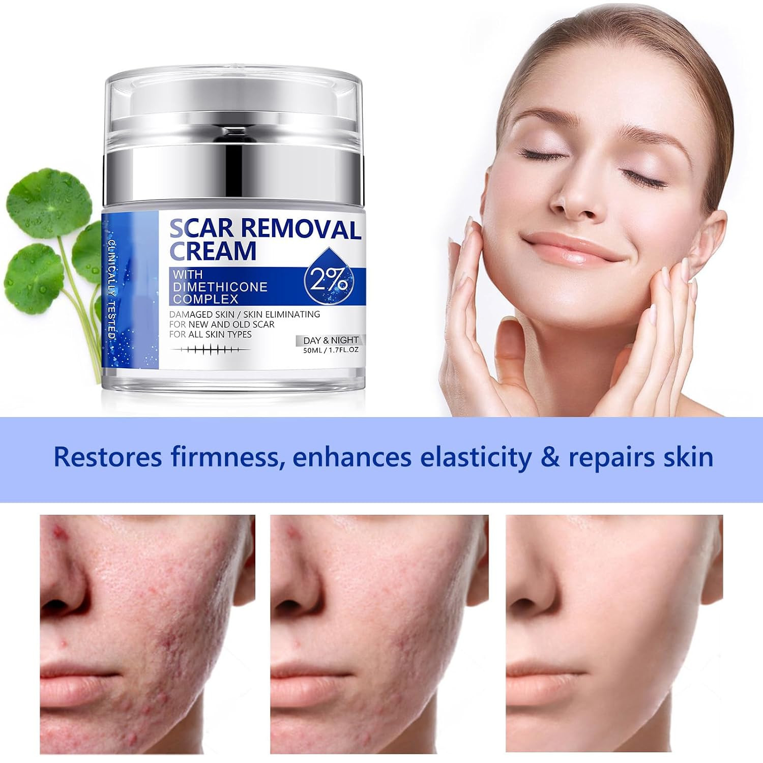 Scar Cream, Scar Removal Cream – Advanced Scar Cream for Surgical Scars, Acne Sc